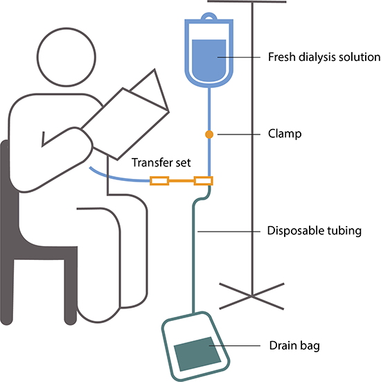 Medical, Dialysis Bag